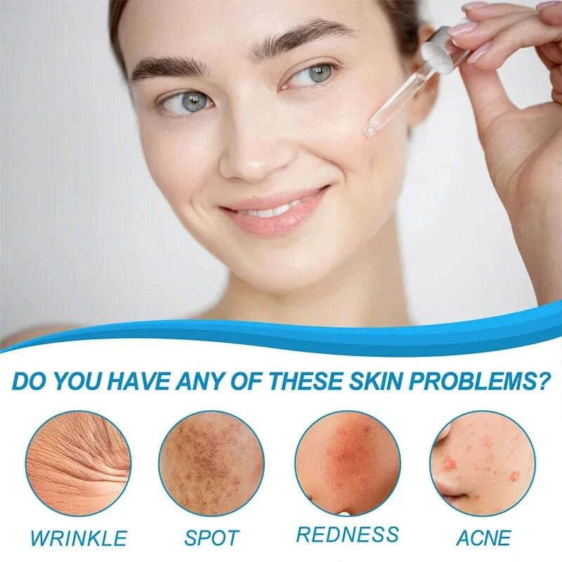 b5-hyaluronic-acid-serum-facial-anti-a-ging-w-rinkle-lift-firming-fine-lines-lightening-dark-circle-skin-brightening-hyalu-serumkimludkimlud-35570379