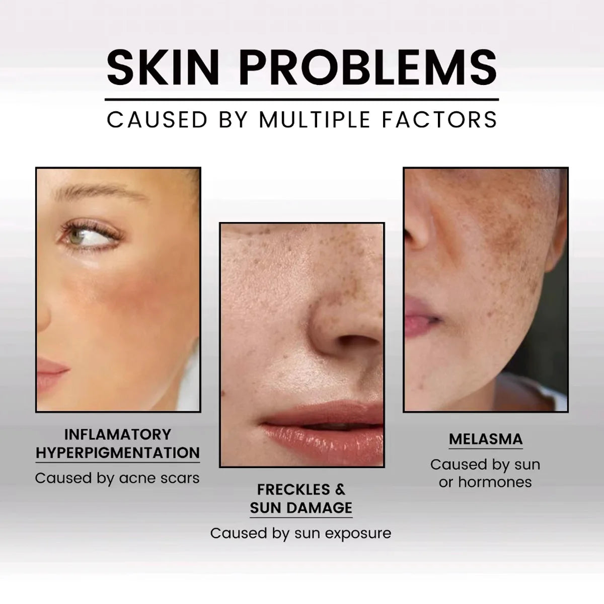 Pure Vitamin E Oil For Face And Body — Clear | KIMLUD