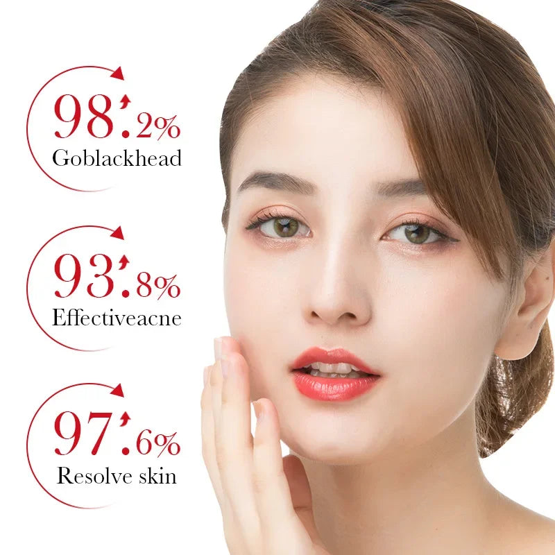 KIMLUD, BIOAQUA Salicylic Acid Acne Removing Essence Face Serum skincare Moisturizing Repairing Acne Treatment Facial Serum Skin Care, KIMLUD Womens Clothes