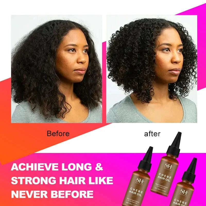 sevich-30ml-africa-traction-alopecia-chebe-hair-oil-crazy-thicken-fast-hair-growing-oil-anti-hair-loss-wildly-grow-long-hair-kimlud-kimlud-33915882