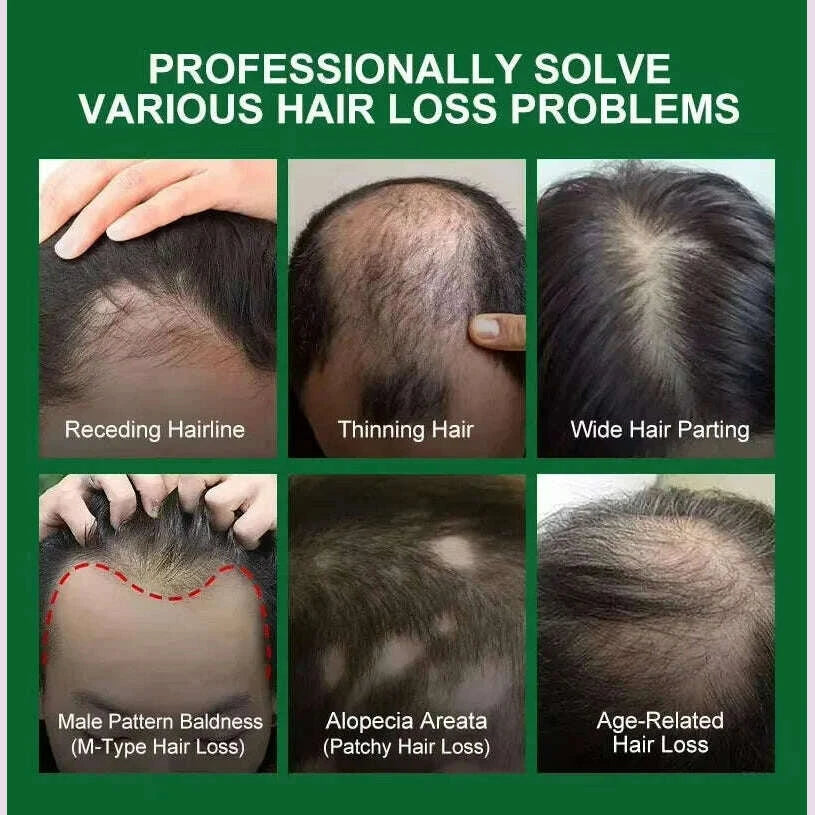 hair-growth-serum-7-days-fast-regrowth-essential-capsule-anti-hair-loss-baldness-repair-damaged-scalp-treatment-for-women-menkimlud-womens-fashion-34619627