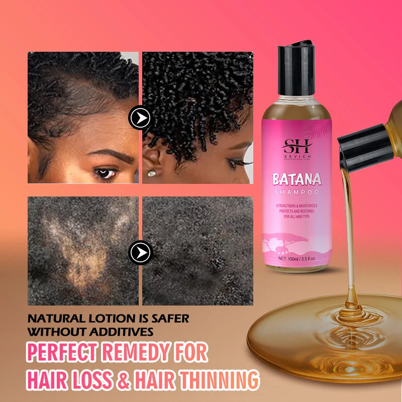 Batana Oil Infused Hair Growth Shampoo And Conditioner Set Anti Hair Loss — Pink | KIMLUD
