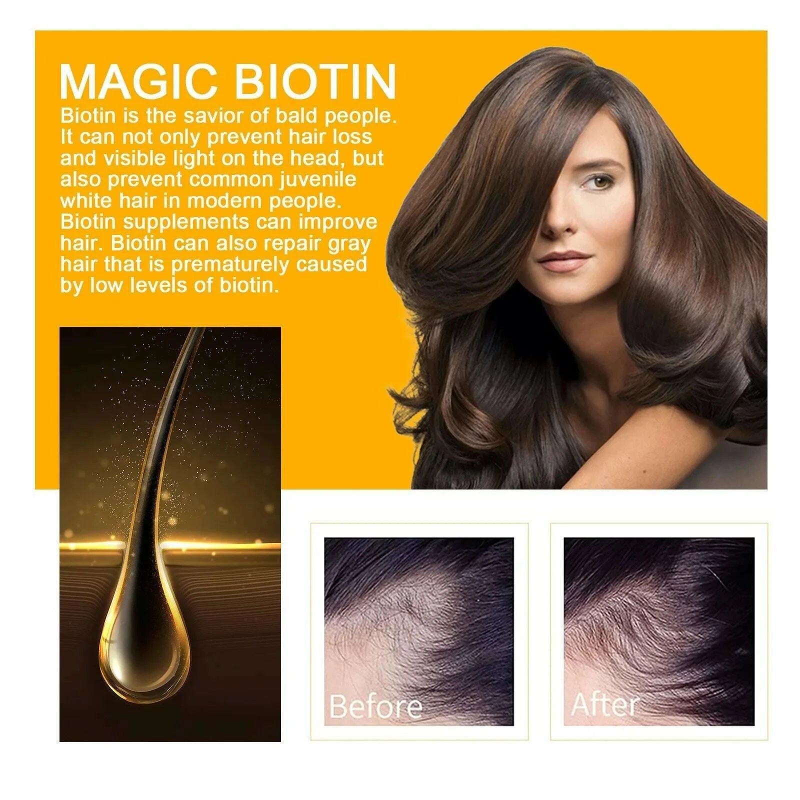biotin-fast-hair-growth-products-anti-hair-loss-serum-spray-prevent-baldness-treatment-scalp-beard-beauty-hair-care-product-kimlud-kimlud-33915863