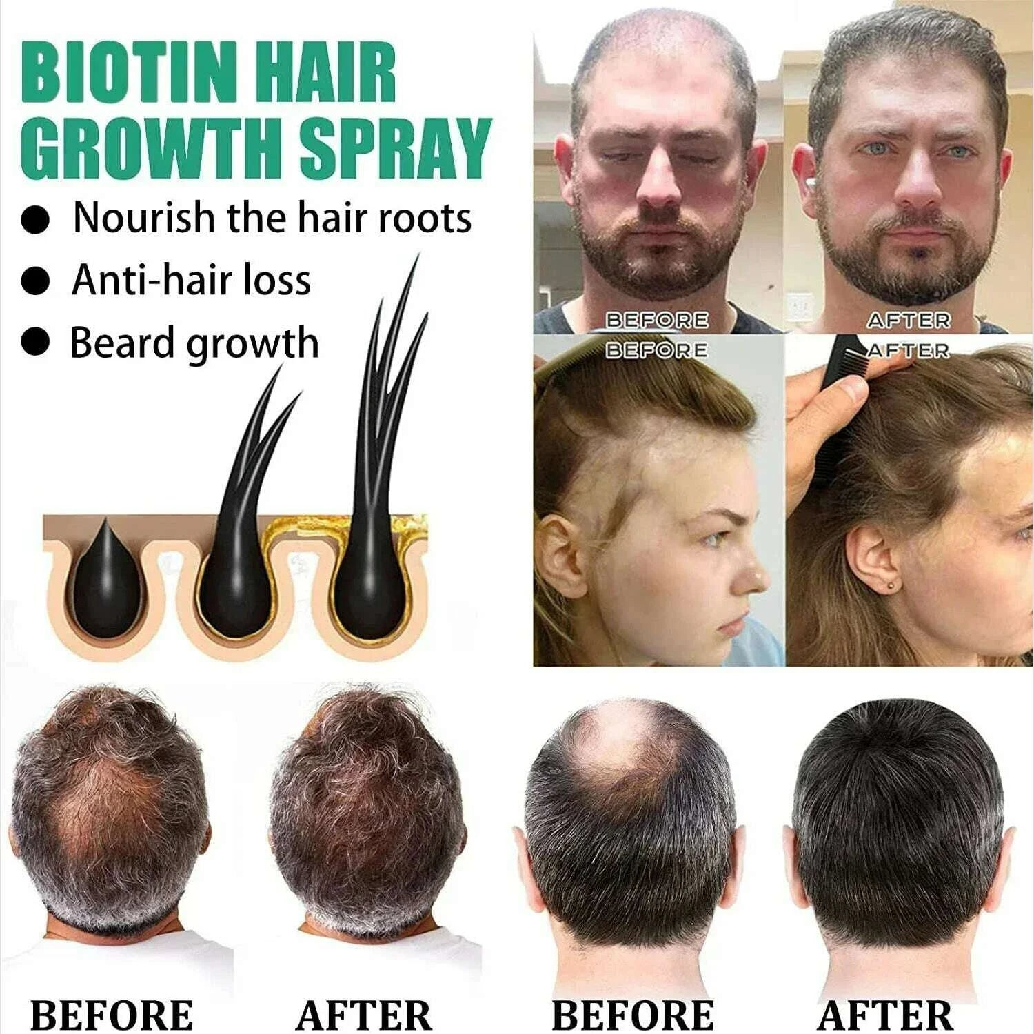 hair-loss-treatment-spray-traction-alopecia-chebe-powder-essential-oil-africa-crazy-hair-growth-products-hair-care-kimlud-kimlud-33911505