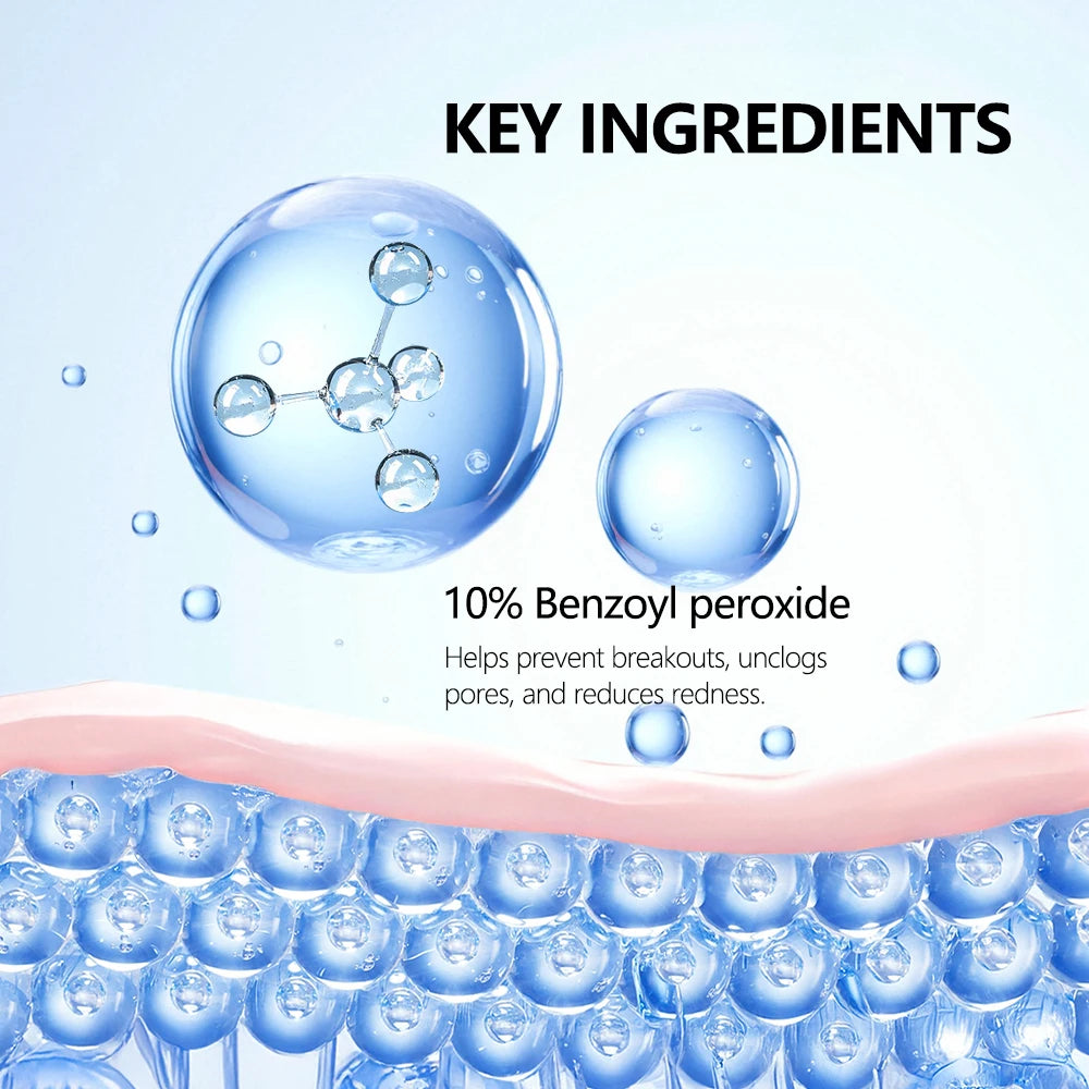 Acne Foaming Wash Benzoyl Peroxide 10% Maximum Antimicrobia Oil-Control Reduces Redness Deep Cleaning for Face & Body Skincare