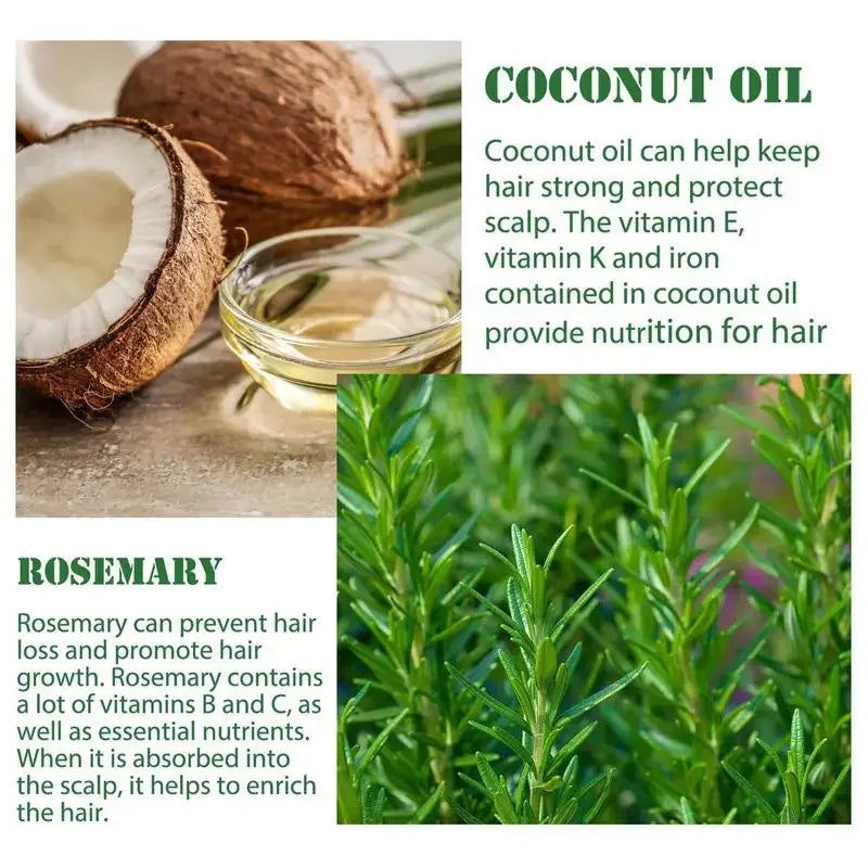 Rosemary Oil Hair Care Nourishing Scalp Oil — Amber | KIMLUD