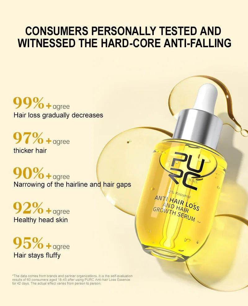 Ginger Hair Growth Essence For Dry Hair And Scalp Care With Nourishing Oils — Gold | KIMLUD