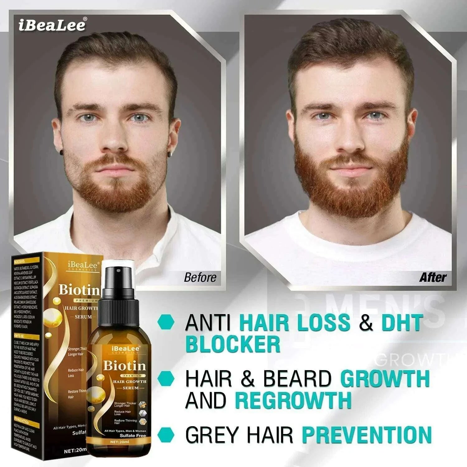 hair-loss-treatment-spray-traction-alopecia-chebe-powder-essential-oil-africa-crazy-hair-growth-products-hair-care-kimlud-kimlud-33911496