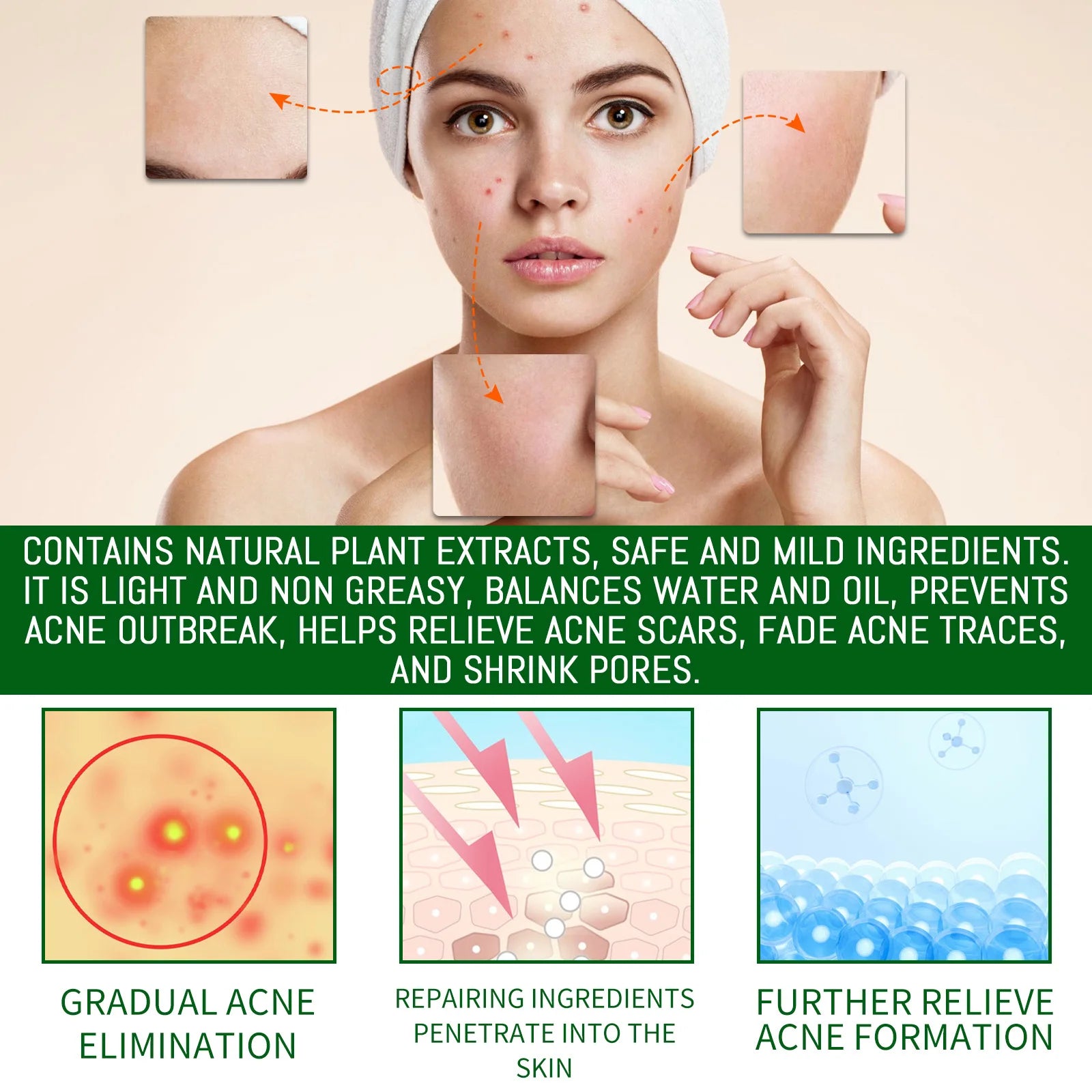 Salicylic Acid Acne Serum For Clearer Pores — Green | KIMLUD