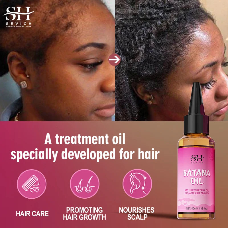 Batana Oil Scalp Massager Tool Set Anti-Hair Loss — Pink | KIMLUD