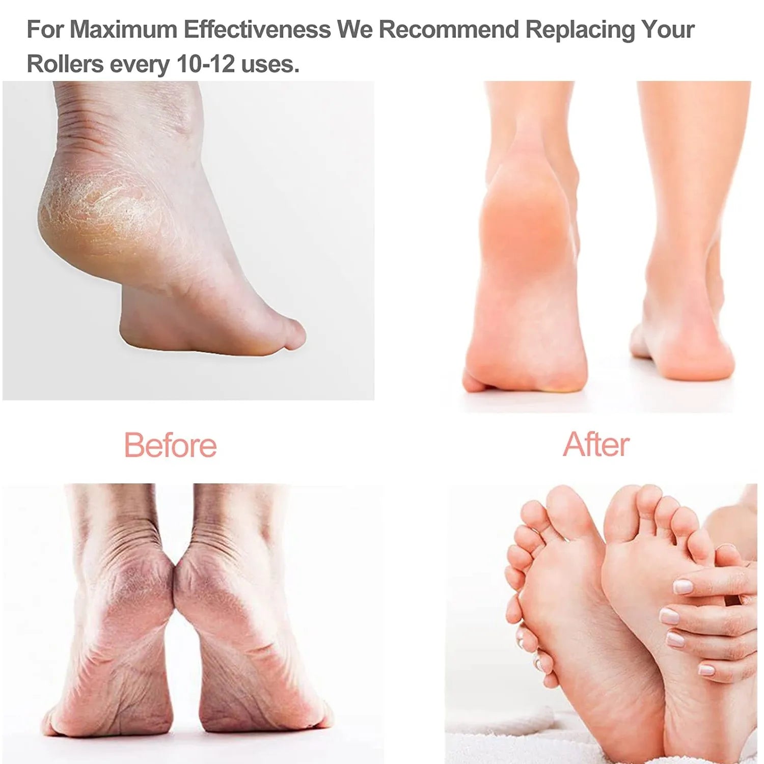 Rechargeable Electric Foot File Callus Remover Pedicure Machine Apparatus for Heels Grinding Device Foot Corns Remove Roller