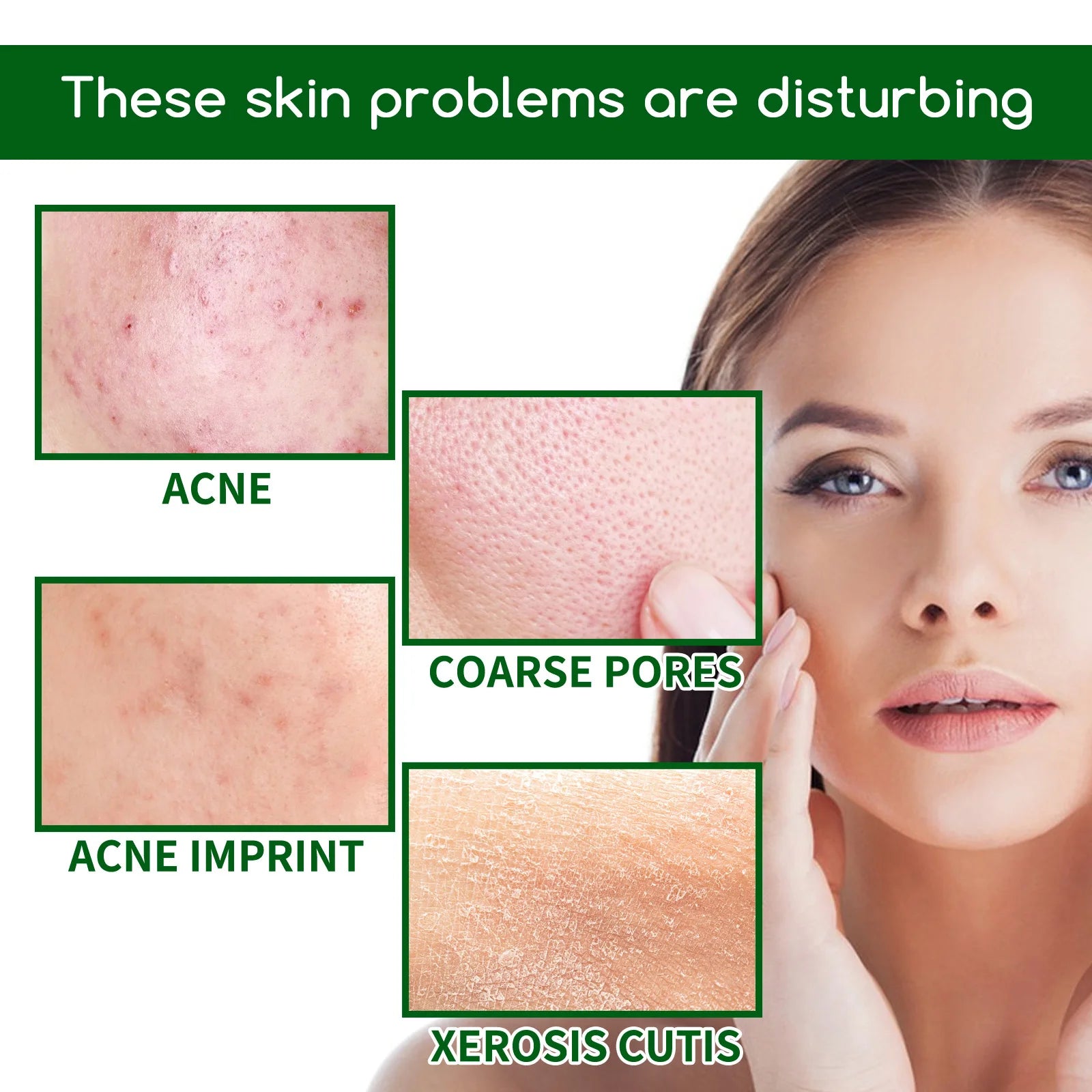 Salicylic Acid Acne Serum For Clearer Pores — Green | KIMLUD