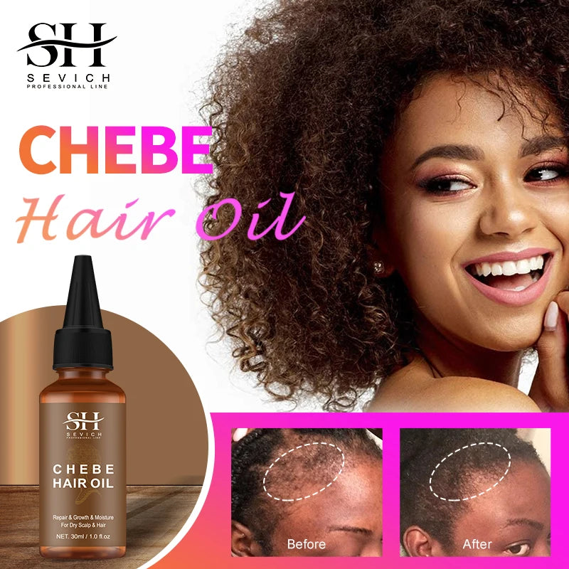 Sevich 30ml Africa Traction Alopecia Chebe Hair Oil Crazy Thicken Fast Hair Growing Oil Anti-Hair Loss Wildly Grow Long Hair
