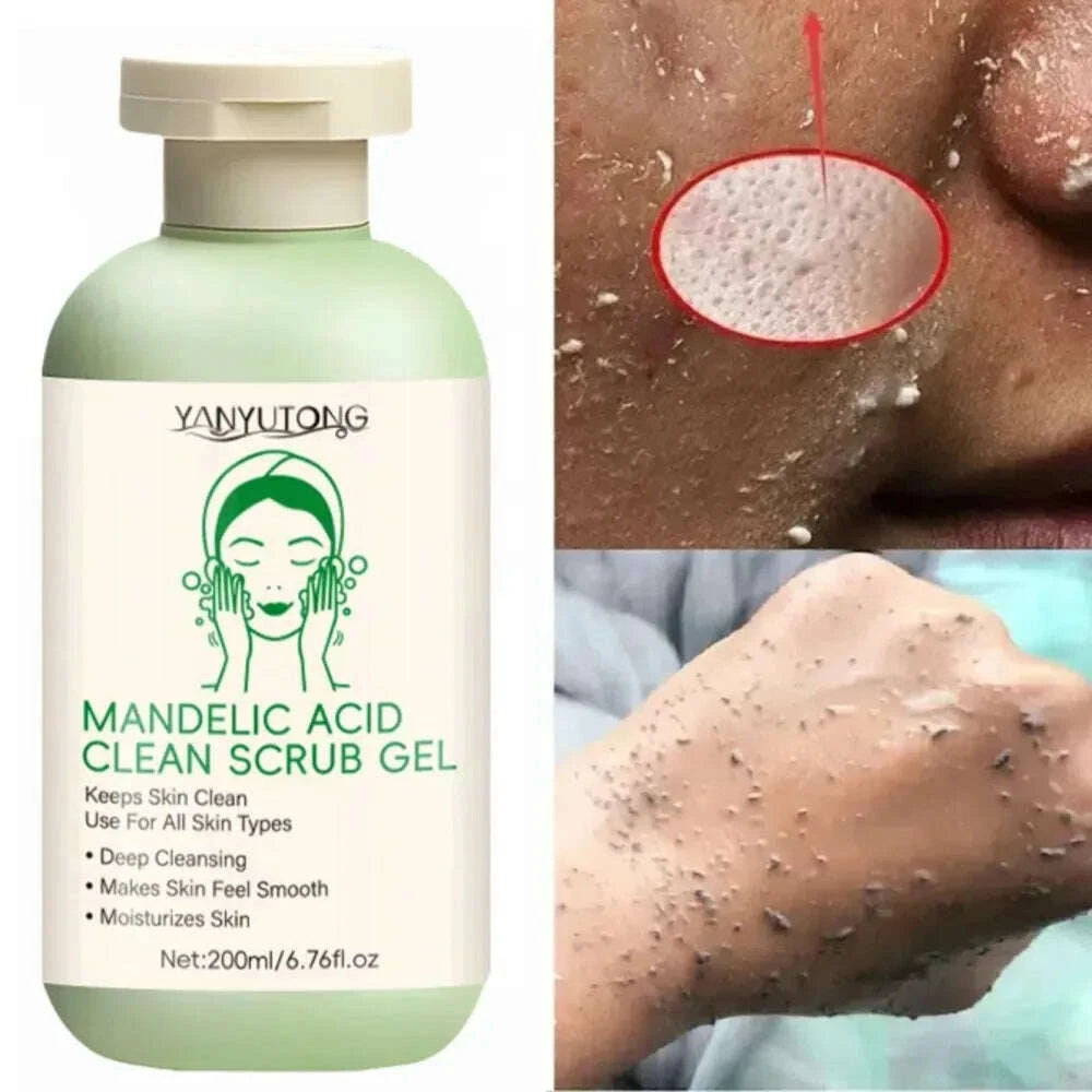 exfoliating-gel-facial-deep-cleansing-pore-cleansing-skin-care-whitening-moisturizing-repair-facial-scrub-skin-carekimludkimlud-35560138