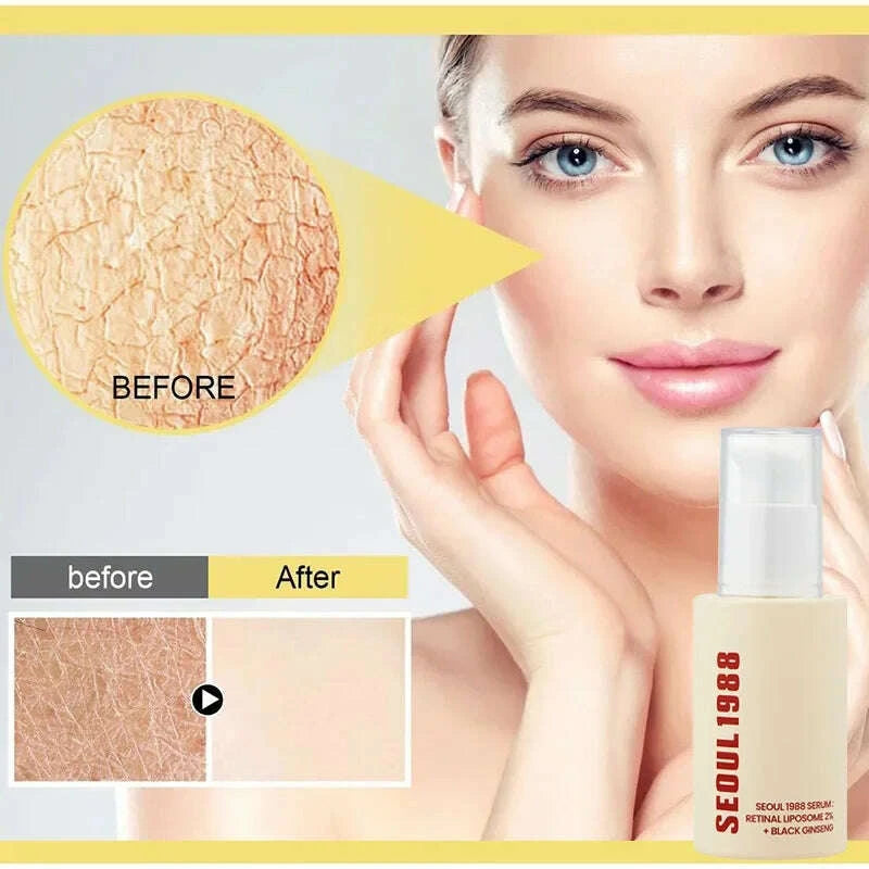 seoul-1988-100ml-niacinamide-2-retinal-ginseng-essence-firming-eye-cream-lightens-fine-lines-deep-moisturizing-care-essence-setkimludkimlud-35570239