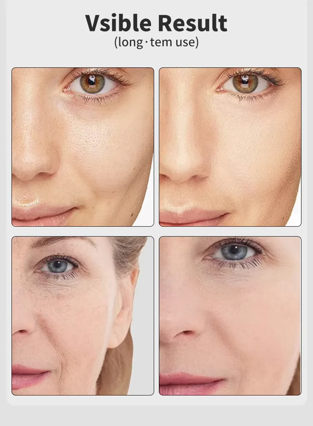 KIMLUD, 7 Colors Age-R Booster Pro Facial Skin Care Anti Wrinkle Beauty Device EMS Microcurrent Lift Massager Home Use Beauty Skin Care, KIMLUD Womens Clothes