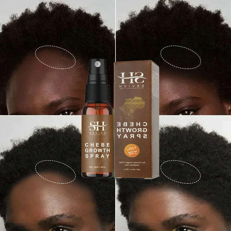 KIMLUD, Africa Chebe Anti Hair Loss Products Traction Alopecia Chebe Powder Thickening Oil Anti Break Fast Hair Growth Hair Care Spray, KIMLUD Womens Clothes
