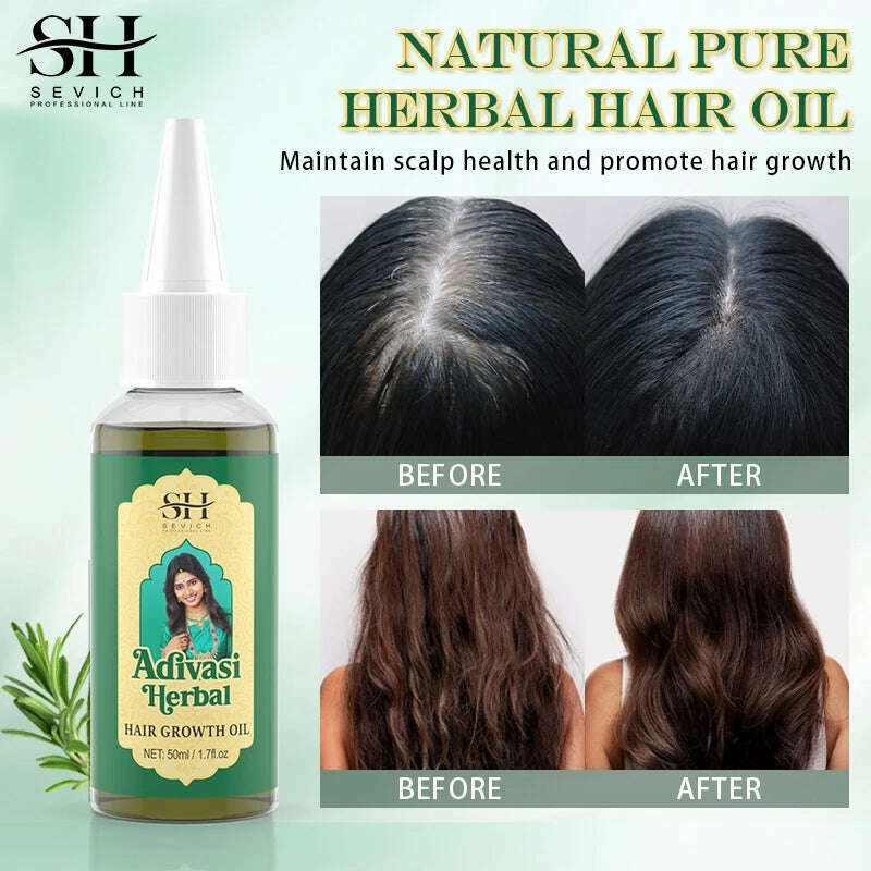 Ayurvedic Hair Growth Oil India Adivasi Organic Hair Growth Serum Anti Hair Loss Fast Regrowth Thicken Oils Hair Growth Products - KIMLUD