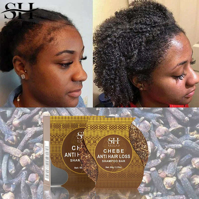 KIMLUD, Fast Hair Growth Oil African Crazy Traction Alopecia Chebe Hair Mask Anti Hair Break Hair Strengthener Hair Loss Treatment Spray, KIMLUD Women's Clothes