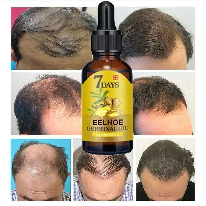 KIMLUD, Fast Hair Growth Oil Ginger Growth Hair Treatment Anti Hair Loss Men Women Scalp Treatment Serum Products Beauty Health Product, KIMLUD Womens Clothes