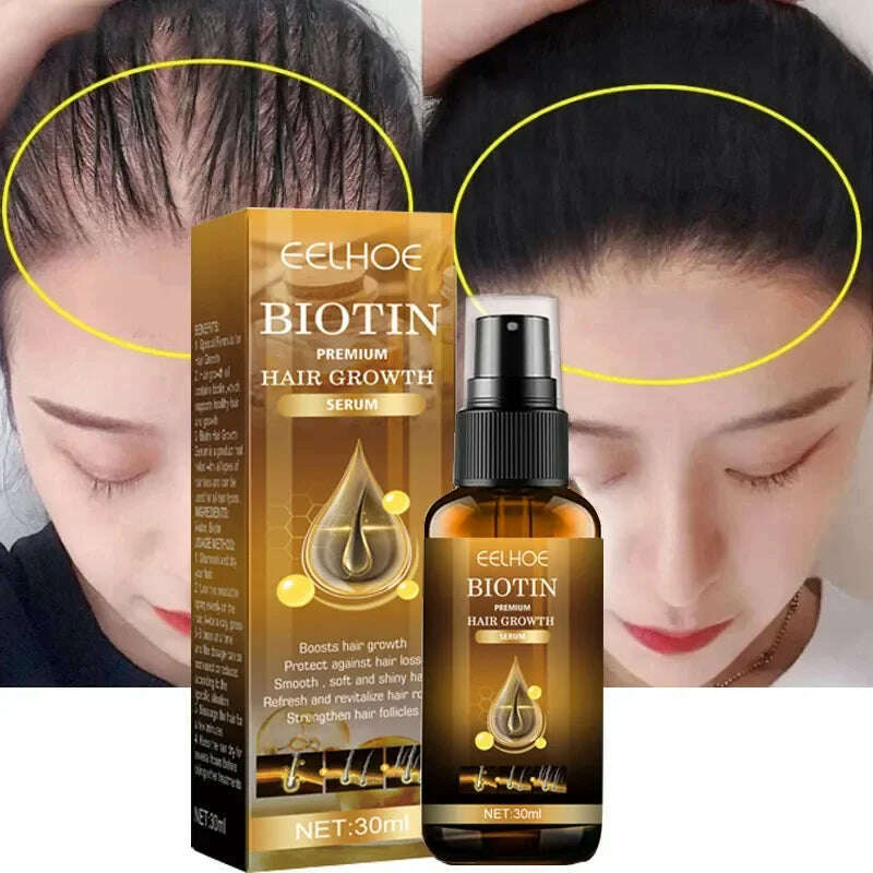 KIMLUD, Fast Hair Growth Spray Products Anti Hair Loss Serum Prevent Baldness Treatment Scalp Dry Damaged Essential Oil Hair Beauty 30ml, KIMLUD Womens Clothes