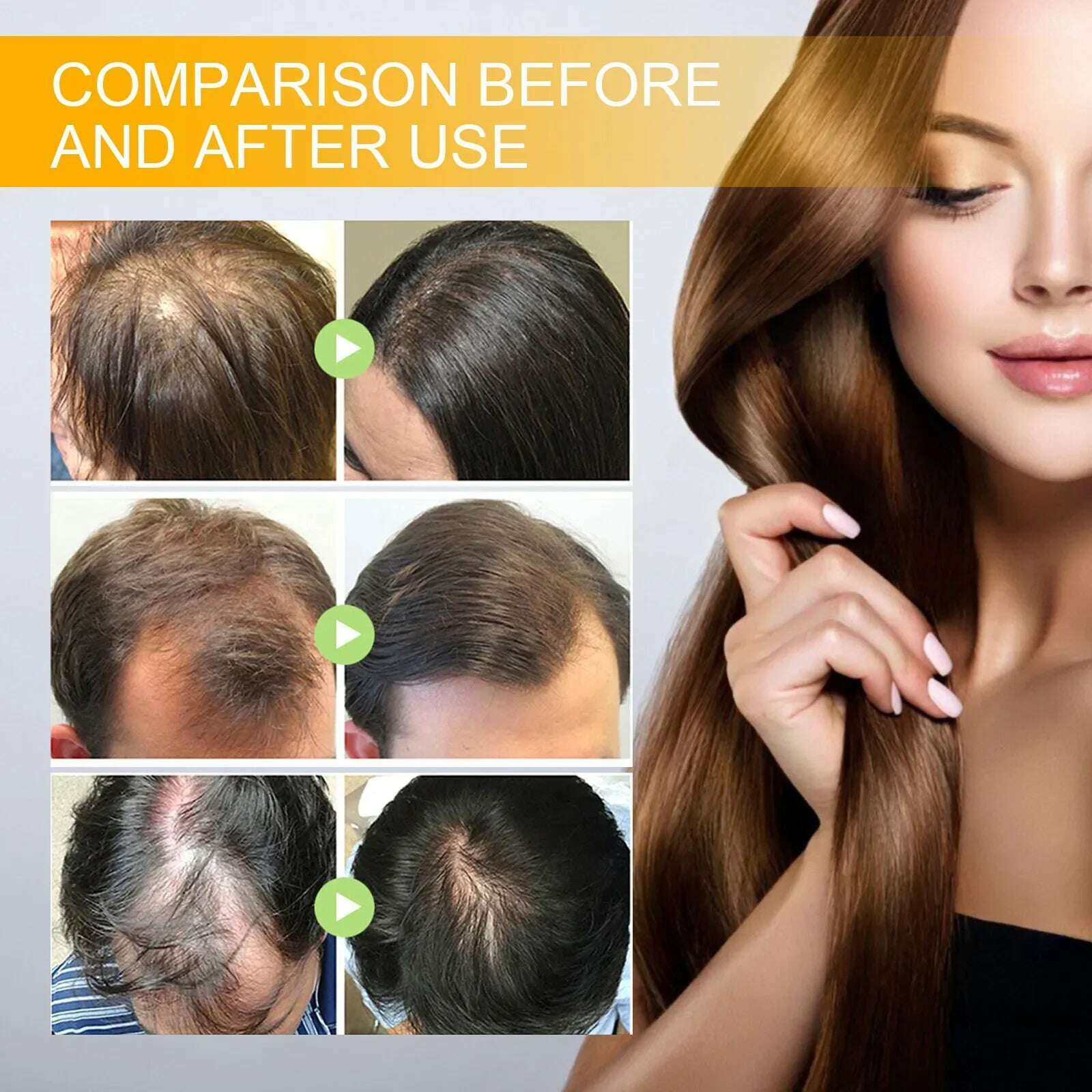 KIMLUD, Fast Hair Growth Spray Products Anti Hair Loss Serum Prevent Baldness Treatment Scalp Dry Damaged Essential Oil Hair Beauty 30ml, KIMLUD Womens Clothes