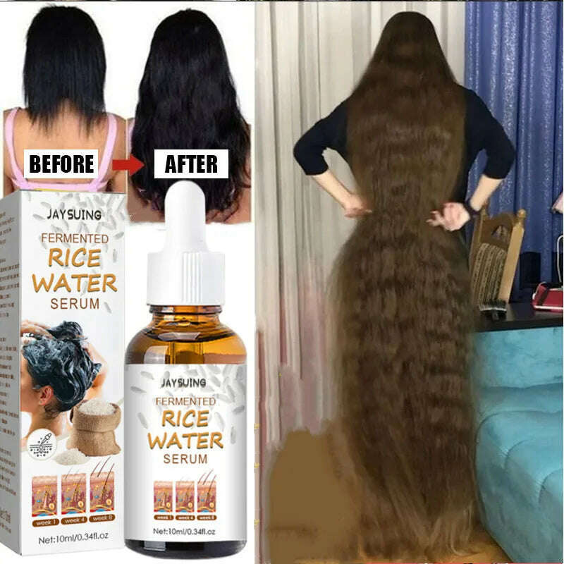KIMLUD, Fermented Rice Water Serum Hair Growth For Thinning Hair And Hair Loss Hair Essence Oil, KIMLUD Womens Clothes