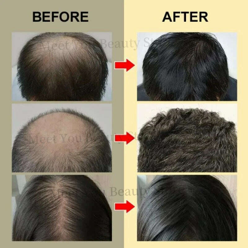 KIMLUD, Ginger Fast Hair Growth Oil Anti Hair Loss Treatment for Man Women Serum Scalp Baldhead Repair Nourish Root Fast Growing Product, KIMLUD Women's Clothes