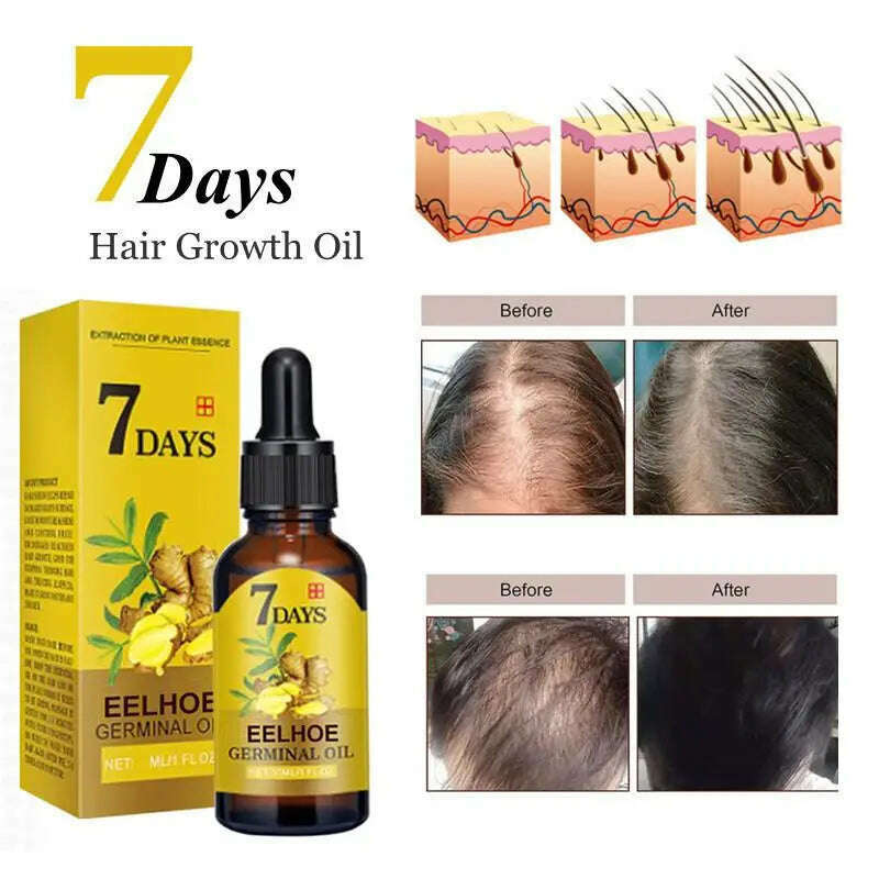 KIMLUD, Ginger Fast Hair Growth Oil Anti Hair Loss Treatment for Man Women Serum Scalp Baldhead Repair Nourish Root Fast Growing Product, KIMLUD Womens Clothes