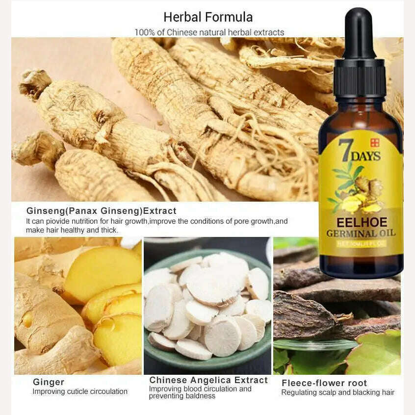 KIMLUD, Ginger Fast Hair Growth Oil Anti Hair Loss Treatment for Man Women Serum Scalp Baldhead Repair Nourish Root Fast Growing Product, KIMLUD Womens Clothes