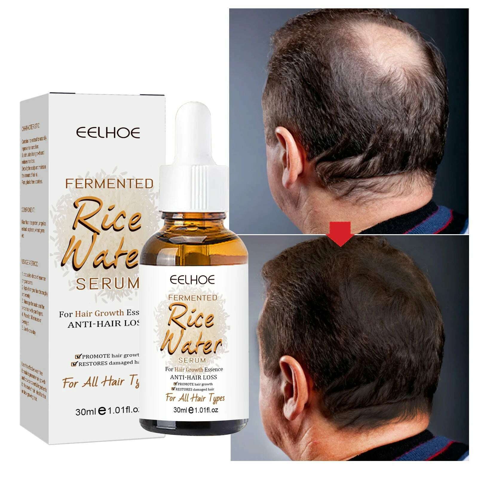 KIMLUD, Hair Growth Essential Fermented Rice Water Repair Hereditary Hair Loss Postpartum Hair Loss Seborrheic Hair Anti Loss Hair Care, KIMLUD Women's Clothes