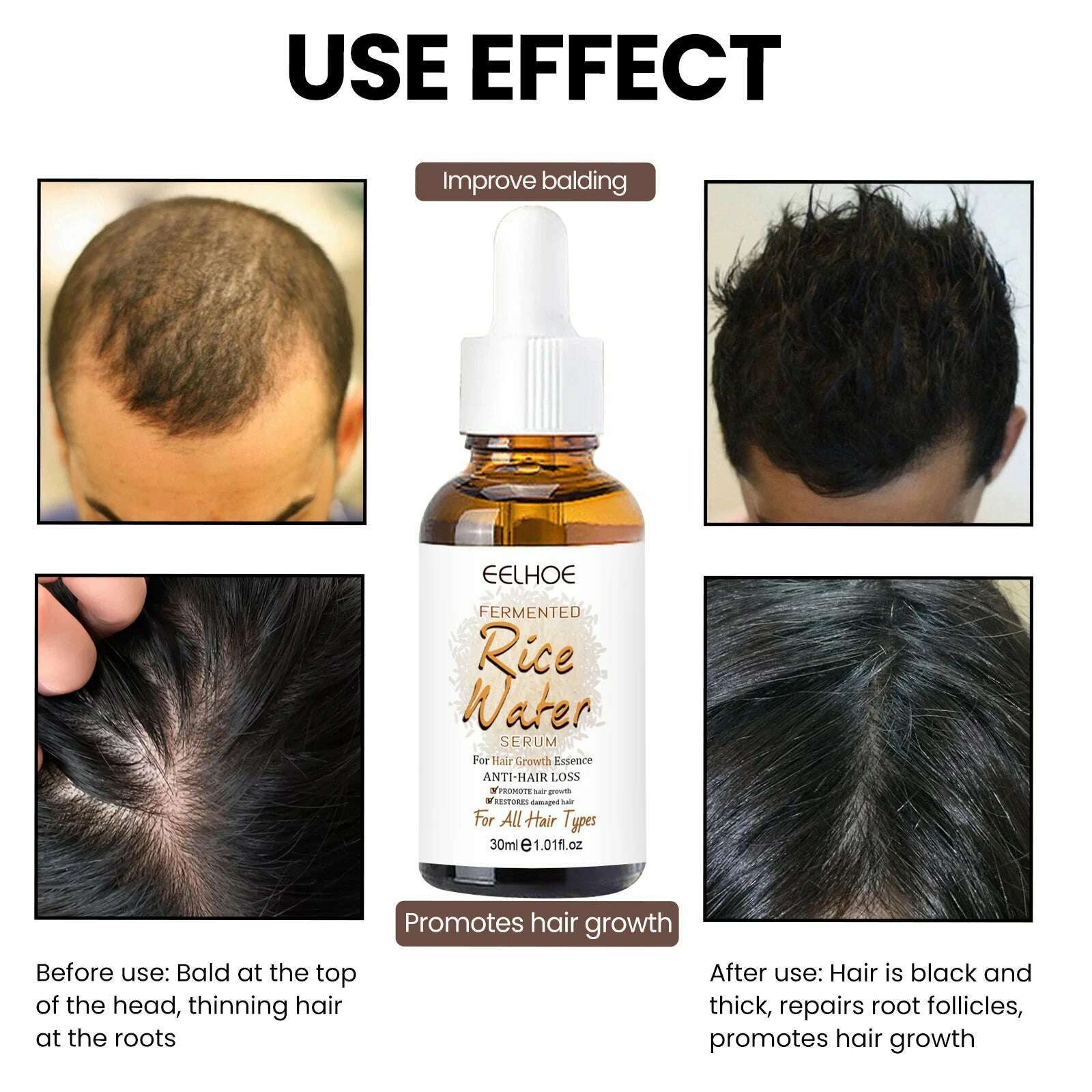 KIMLUD, Hair Growth Essential Fermented Rice Water Repair Hereditary Hair Loss Postpartum Hair Loss Seborrheic Hair Anti Loss Hair Care, KIMLUD Womens Clothes
