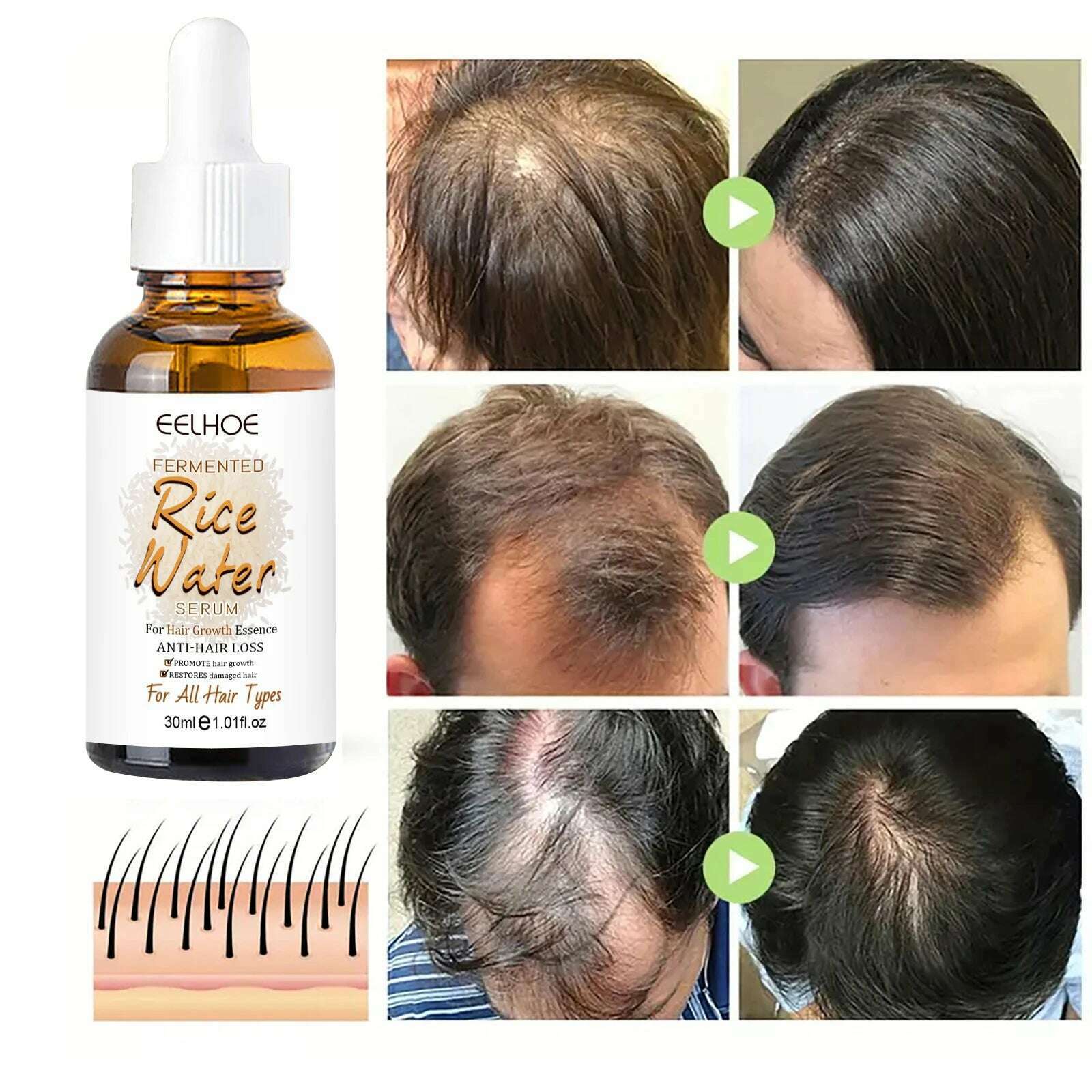 KIMLUD, Hair Growth Essential Fermented Rice Water Repair Hereditary Hair Loss Postpartum Hair Loss Seborrheic Hair Anti Loss Hair Care, KIMLUD Women's Clothes