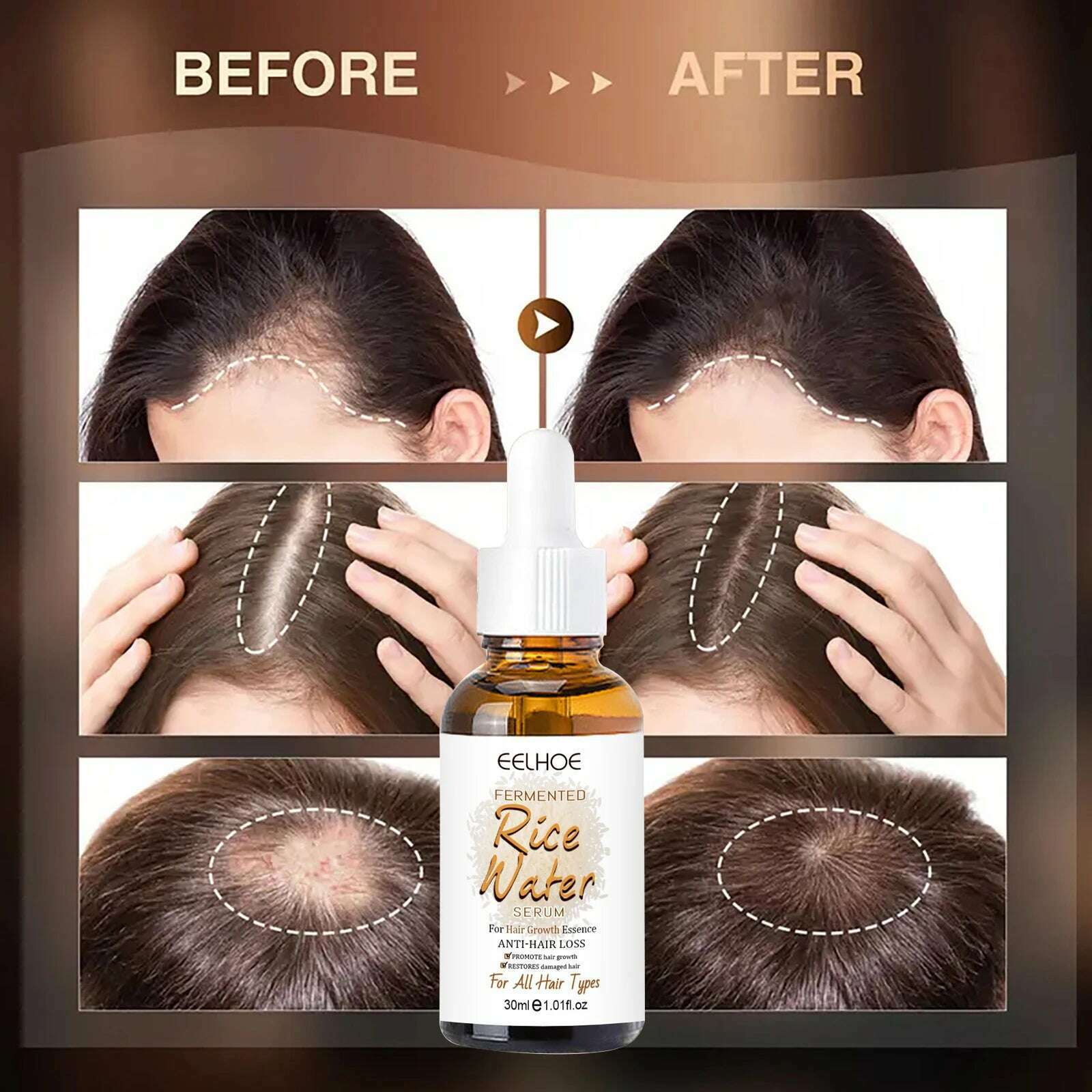 KIMLUD, Hair Growth Essential Fermented Rice Water Repair Hereditary Hair Loss Postpartum Hair Loss Seborrheic Hair Anti Loss Hair Care, KIMLUD Womens Clothes