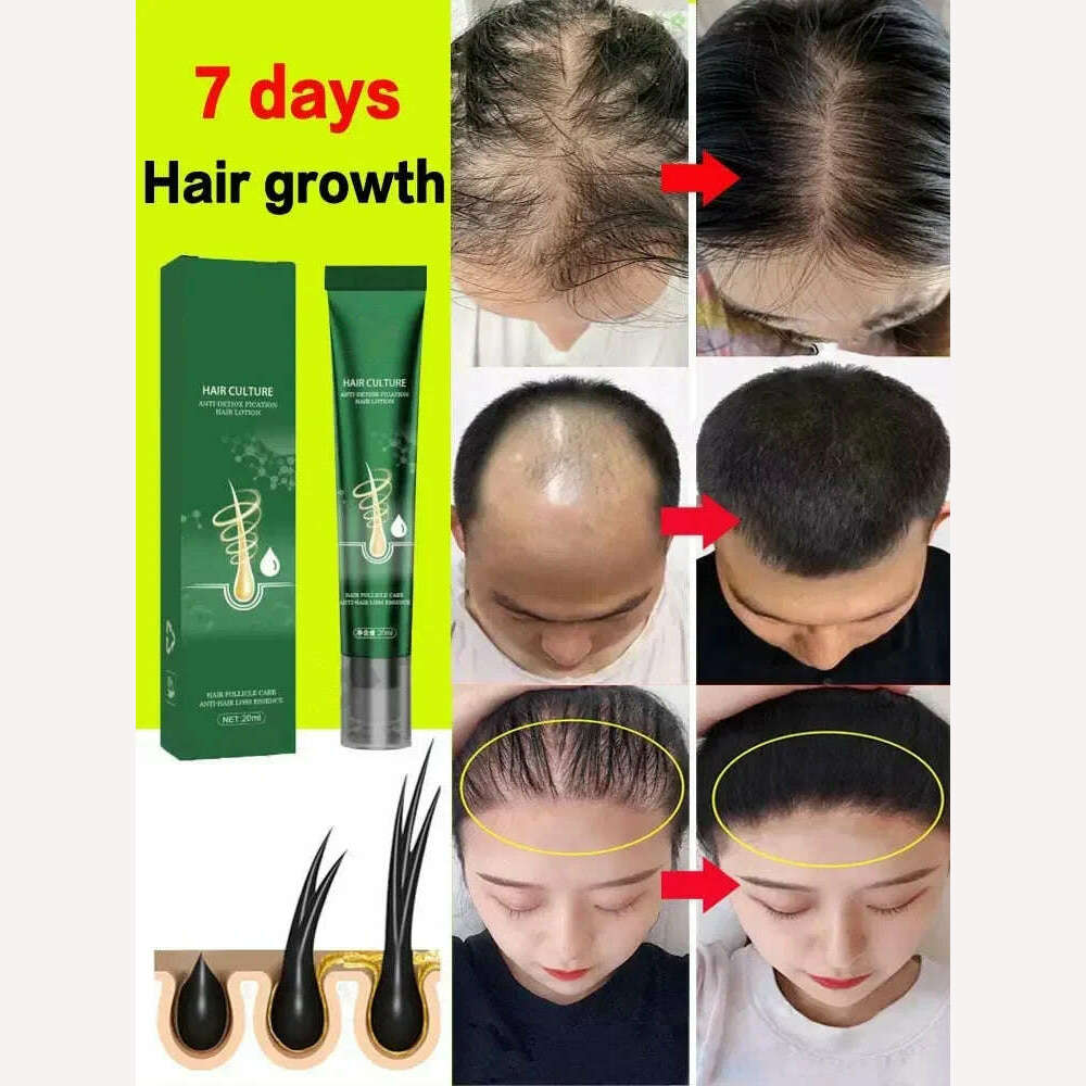 KIMLUD, Hair Growth Oil Fast Growing Hair Effective Essential Baldness Repair Hereditary Anti Postpartum Seborrheic Hair Loss Products, KIMLUD Women's Clothes