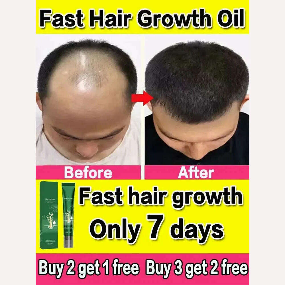 KIMLUD, Hair Growth Oil Fast Growing Hair Effective Essential Baldness Repair Hereditary Anti Postpartum Seborrheic Hair Loss Products, KIMLUD Women's Clothes