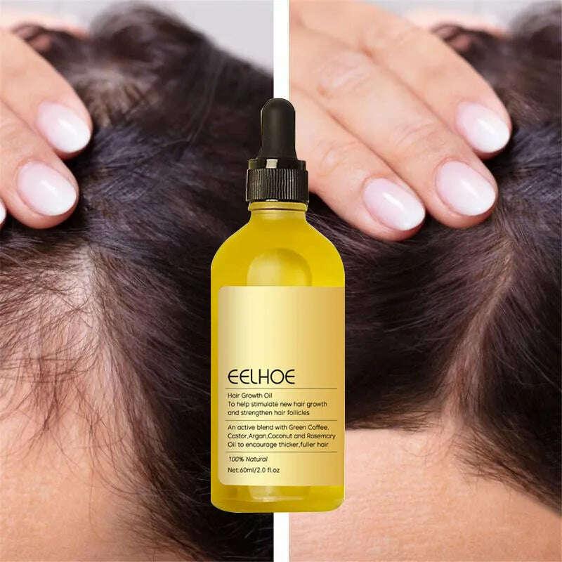 KIMLUD, Hair Growth Products Prevent Hair Loss Essential Oil Fast Growing Anti-Drying Scalp Treatment Repair Beauty Health for Men Women, KIMLUD Womens Clothes