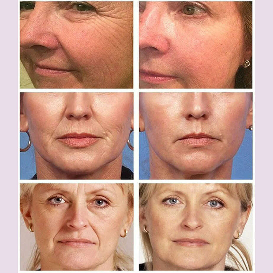 KIMLUD, Magic Wrinkle Remover Face Cream Anti-Aging Fade Fine Line Lifting Firming Whitening Moisturizing Beauty Skin Care Cosmetic 118g, KIMLUD Womens Clothes