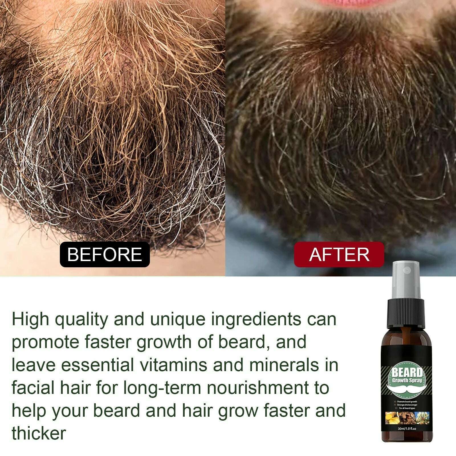KIMLUD, Men Beard Growth Essential Oils Essence Spray Nourishing and Moisturizing Spray Beard Care Grooming Oil, KIMLUD Women's Clothes
