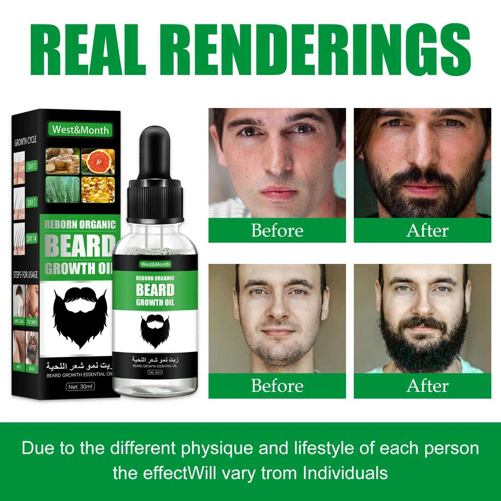 KIMLUD, Men Beard Growth Roller Set Beard Growth Kit Men's Growth Essence Nourishing Enhancer Oil Spray Beard Care, KIMLUD Womens Clothes