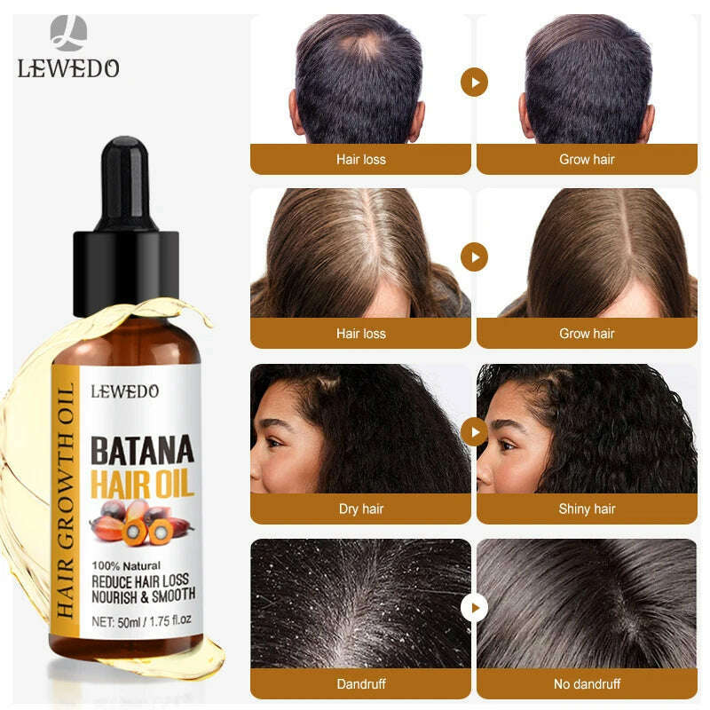 Natural 100% Pure Batana Oil For Hair Growth Batana Oil Butter Hair Mask From Honduras Hair Loss Treatment For Black Men & Women - KIMLUD