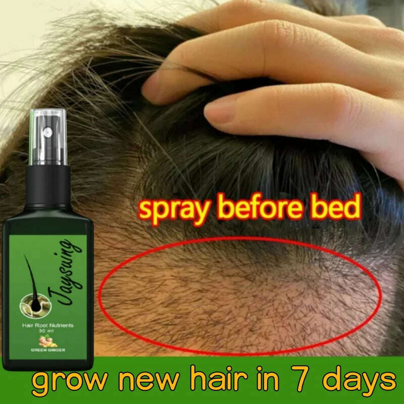 KIMLUD, Natural Ginger Hair Growth Spray Hair Roots Fast Grow Anti Hair Loss Serum Liquid Scalp Damaged Treatment Repair Beauty Health, KIMLUD Womens Clothes