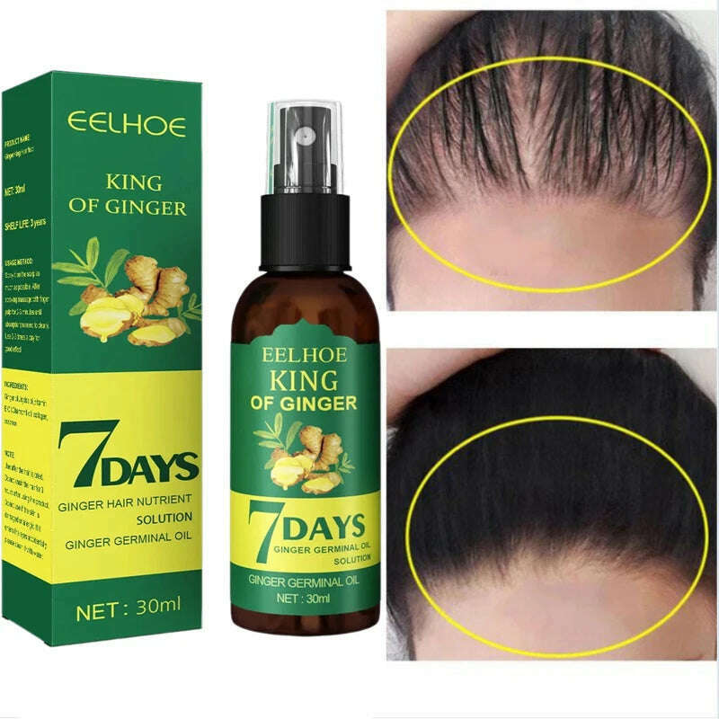 KIMLUD, Rapid Growth Hair Serum Spray Repair Baldness Hair Follicles Hereditary Hair Loss Postpartum Hair Loss Seborrheic Hair Care, KIMLUD Women's Clothes
