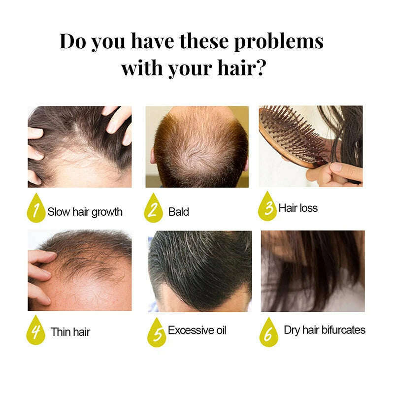 KIMLUD, Rapid Growth Hair Serum Spray Repair Baldness Hair Follicles Hereditary Hair Loss Postpartum Hair Loss Seborrheic Hair Care, KIMLUD Women's Clothes