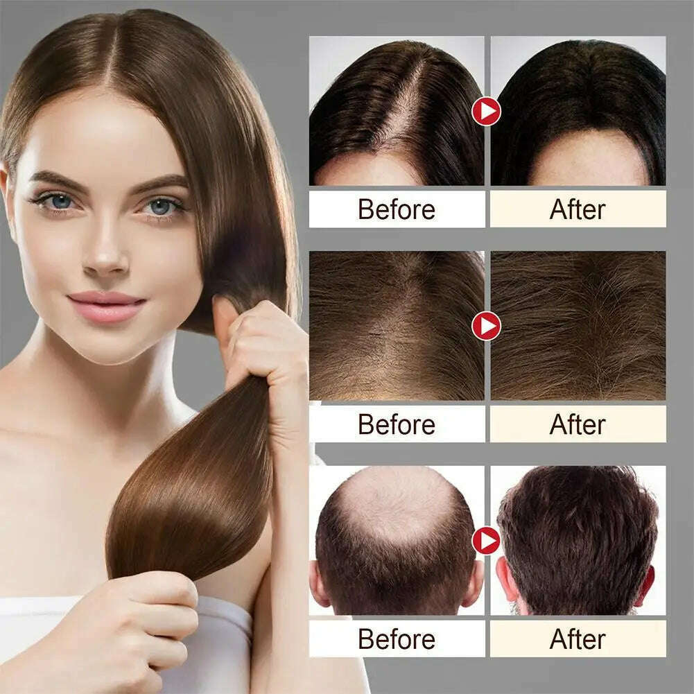 KIMLUD, Rice Dense Hair Spray Rice Water Spray Serum Snti-Hair Loss Seborrheic Hair Loss Repair Rice Shampoo For Men Women, KIMLUD Women's Clothes