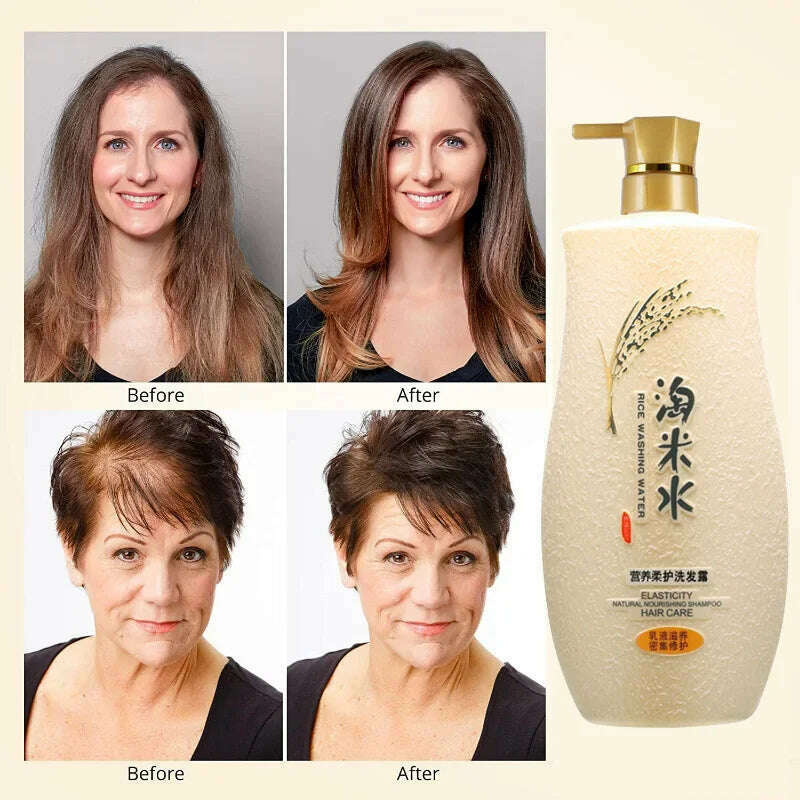 KIMLUD, Rice Water for Hair Growth Anti-dandruff Anti-itch Anti-hair Loss Prevent Thinning Restore Luster Repair Damaged Hair 750ml, KIMLUD Womens Clothes