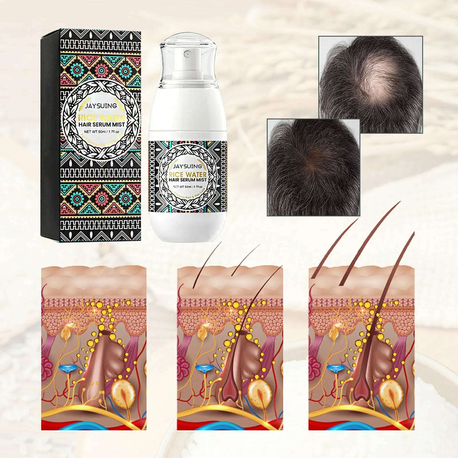 KIMLUD, Rice Water Hair Spray Anti Alopecia For Growth Longer Thicker Healthier Repair Dry Damaged Hair Nourishing Hair Follicles Serum, KIMLUD Women's Clothes