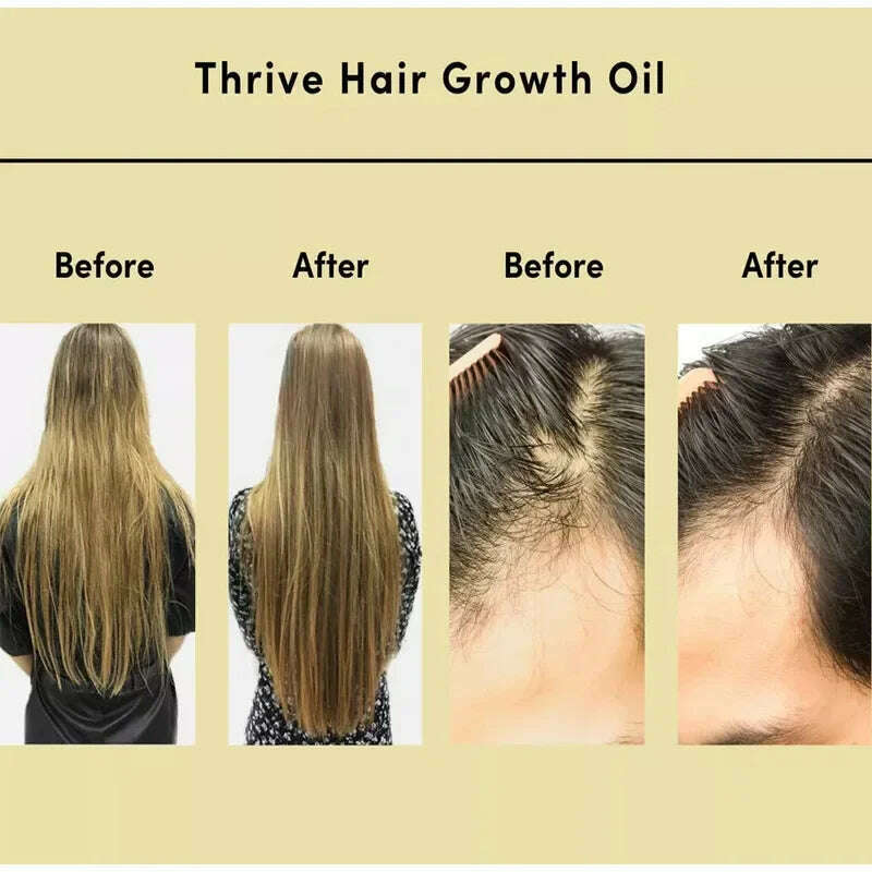 KIMLUD, Thrive Grown Hair Oil Anti Hair Loss Scalp Treatment Serum Gisou Rosemary Oil for Hairs collagen cabello hair care, KIMLUD Womens Clothes