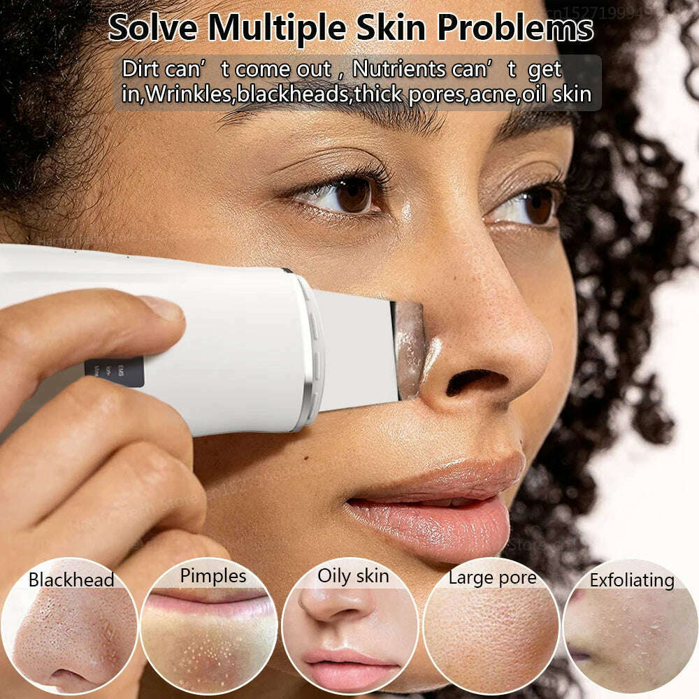 KIMLUD, Ultrasonic Peeling Remover Blackhead Facial Skin Scrubber Facial Shovel Deep Cleaning Face Lifting Removal Pore Acne EMS Lift, KIMLUD Womens Clothes